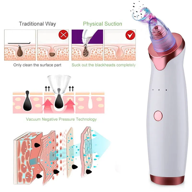 Electric Blackhead & Acne Remover