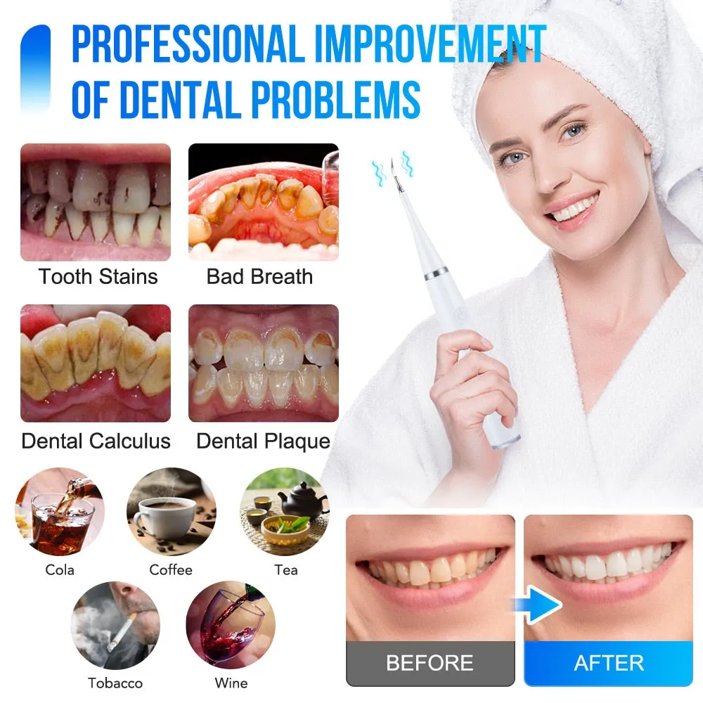 Electric Dental Calculus Remover Dental Cleaning Device Teeth Cleaner
