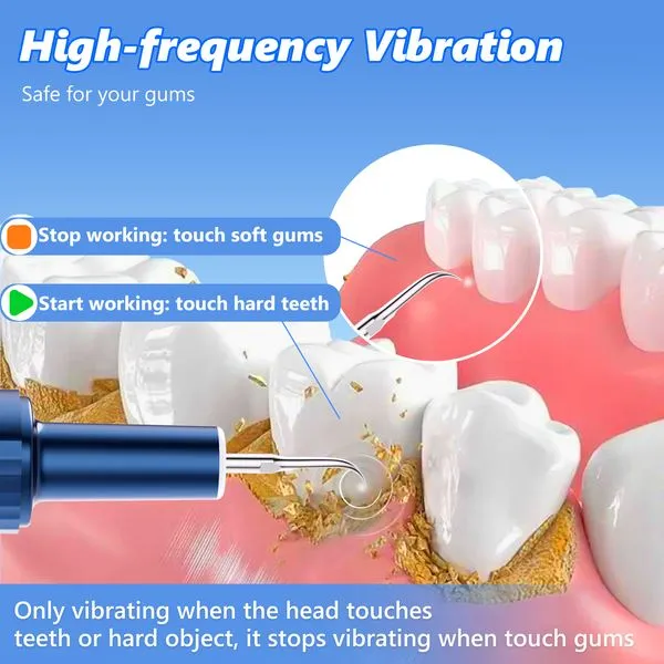 Electric Plaque Remover for Teeth, Rechargeable Teeth Cleaning Kit with 4 Modes